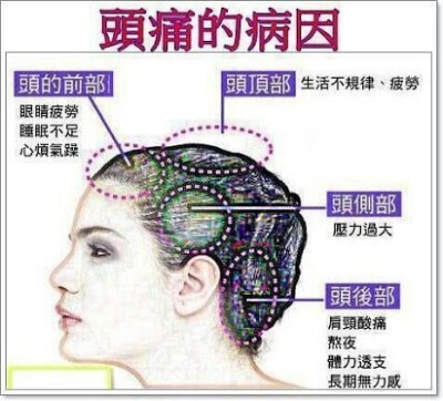 头痛的病因