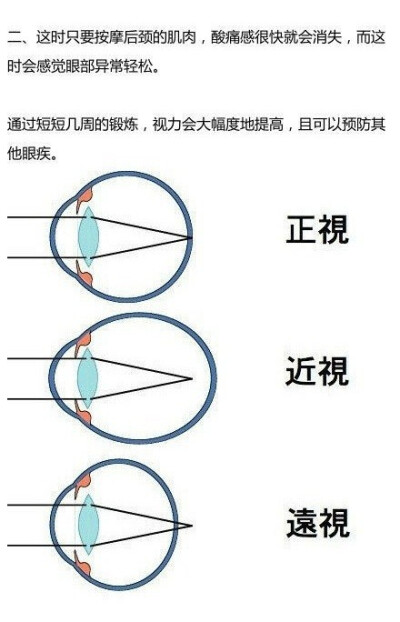 【拒绝近视】网上看到的中医治疗近视的科学简便方法，分享给你周围的四眼小伙伴们吧！