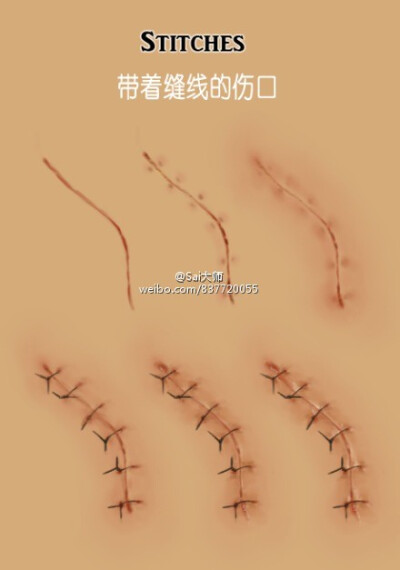 #绘画学习# 【 烧伤丶结痂丶裂痕丶抓痕丶擦伤丶以及手速缝合伤口的画法参考素材】收藏转需~ （by：phenergan）