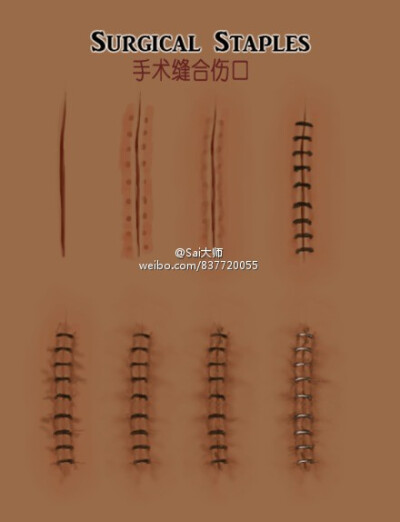 #绘画学习# 【 烧伤丶结痂丶裂痕丶抓痕丶擦伤丶以及手速缝合伤口的画法参考素材】收藏转需~ （by：phenergan）