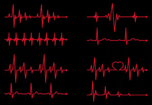 触漫素材心电图