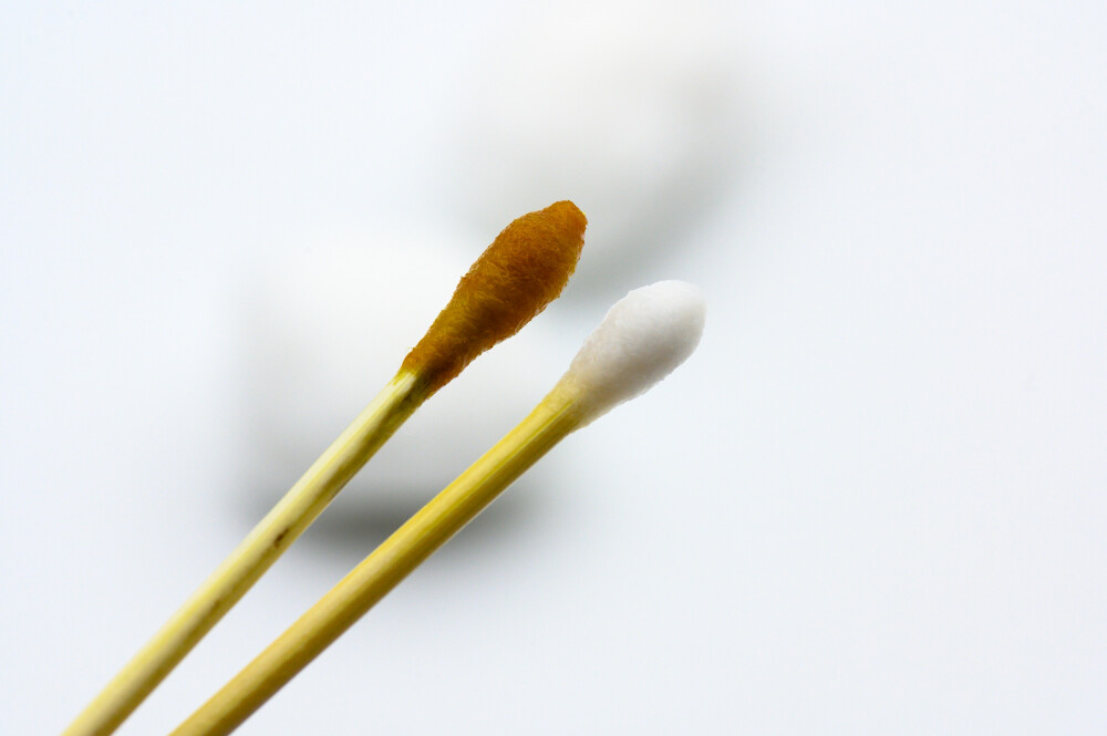 棉签 棉球 棉棒 碘伏 酒精 白色背景 碘酒 脱脂棉 棉花 木制品 木棍 木材 医疗 医用 外伤 消毒 擦拭 涂擦 涂抹 上药 擦药 涂药 抹药 医疗用具 医疗器械 医用工具 医生 保健 保护 病人 医院 门诊 医疗工具 体检 专业人员 卫生保健 生活方式 摄影 医护 健康 静物 特写 清洁 干净
