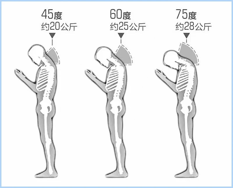 看到这一条是不是想说：
谁不低头玩手？？？
确实这年头没有谁不沉迷于玩手机，
但是吧咱没必要非得低头玩！
因为它不仅是会对颈椎带来伤害，
还会让你产生双下巴和颈纹！！！
我们只要稍微的低点头（30°左右），
脖子就会感到收紧了，
这个时候它受到的压力是平时的3倍！
而皮肤会在重力的牵引下，
逐渐松弛...
