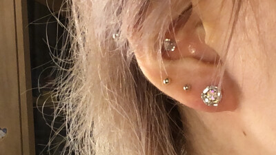 耳钉 微笑钉 耳蜗钉 耳桥