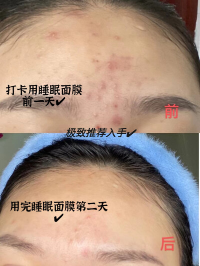 PUGEE睡眠面膜推荐入手:
独立包装很卫生一盒里面有六颗
独立无菌包装能够保证产品最佳效果，这是很多
同类睡眠面膜做不到的，这个设计真的很用心。
抹上去毛孔都在吸收！！第二天起床皮肤像剥了
壳的鸡蛋·一样光…