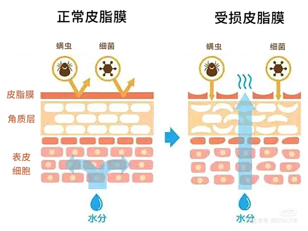 护肤