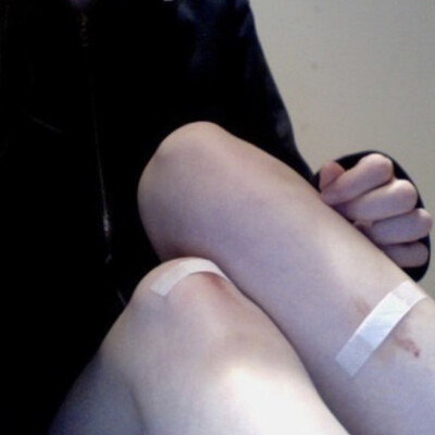 好敏感，我就是一块小玻璃