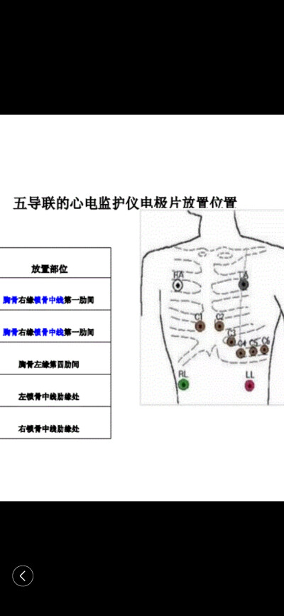 心电监护