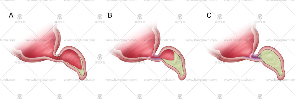 医学动画论文配图杂志sci封面设计科研绘图教程三维动画
sci绘图论文配图3d科研绘图学术期刊封面设计医学插画
科研绘图邦图文化论文配图杂志封面设计医学插画
邦图文化科研绘图SCI画图学术杂志封面设计TOC示意图
医学插画，医学动画，科研动画，三维动画，信号通路图，ps科研绘图，AI科研绘图，SCI科研绘图
sci杂志封面设计