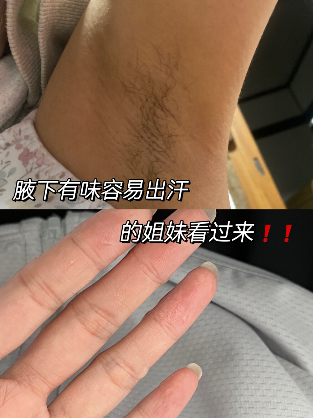 狐臭界的黑马！！用一次就惊艳一次！
夏天来啦，狐臭党们的噩梦又开始了，胳肢窝总是出汗浸湿短 袖，还有一股难以形容的味道。这时候就需要一个止汗露！我 也是最近才挖到的方法：先用香皂洗干净腋下，然后喷上良力 丝喷剂，可以快速止汗，能清爽两三天！！隔几天用酒精擦一 下胳肢窝，抑制细箘滋生！
我用了一段时间狐臭就已经淡了很多！
希望大家没有暴汗异味烦恼！！ 