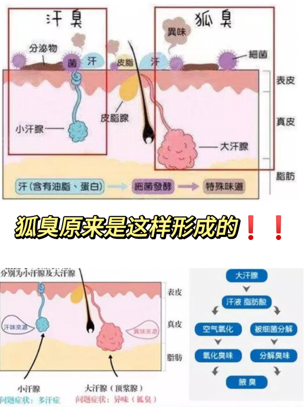 狐臭真的没办法好了吗？我来告诉你实话！！
有狐臭并不可怕，可怕的是不管它??！
作为一个多年狐臭人，我清楚了解狐臭其实就是腋下的大汗腺分泌物 （汗液）被细箘分解产生的特殊臭味！
根据他产生的原因来找方法解决起来就简单多了。
1.减少皮肤表面的细箘
腋下比较容易藏脏东西，每天洗澡的时候用硫磺皂清洗腋下，可以破 坏细箘群，减少了汗液变臭的几率
2.止汗
用这个可以快速止汗的良力丝喷剂，喷在腋下凉凉的也不黏腻。喷完 之后腋下干爽舒适，狐臭味一天天变淡的感觉真好??！
夏天腋下不会再湿漉漉的啦??！ 