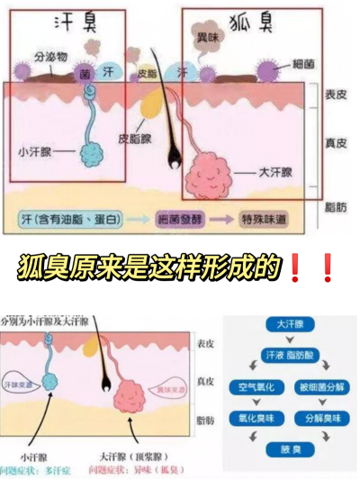 狐臭真的没办法好了吗？我来告诉你实话！！
有狐臭并不可怕，可怕的是不管它！！
作为一个多年狐臭人，我清楚了解狐臭其实就是腋下的大汗腺分泌物 （汗液）被细箘分解产生的特殊臭味！
根据他产生的原因来找方法解…