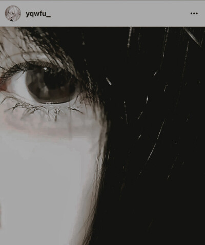 寄生虫 $ 结疤（Prod. JpBeatz)