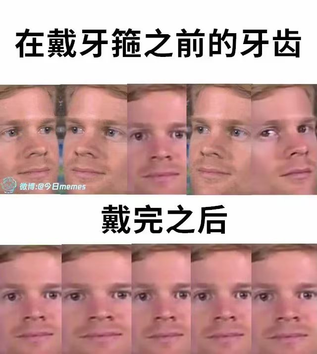 表情