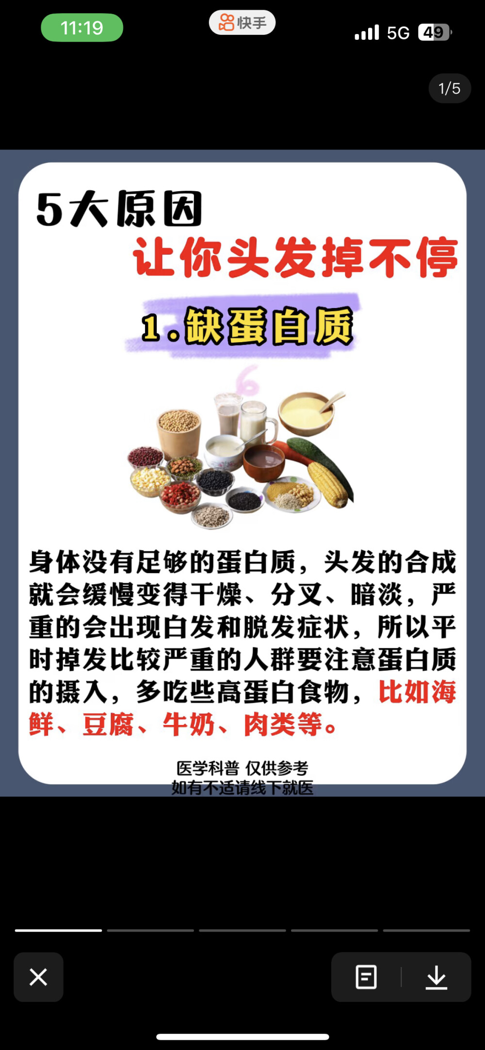 脱发的建议
对于脱发问题，可以采取以下措施：
均衡摄取头发生长所需的优质蛋白质、铁、钙、硫以及维生素A、B、D、E等营养物质。
合理生活作息，缓减精神压力。 避免熬夜，尽量按时起居，保证充足睡眠，减缓精神压力。在工作生活中，更要勇于面对竞争、挫折和失败，努力减缓精神压力，保持积极向上的心态和乐观愉快的情绪。
及时修剪头发，正确护理保养。 头发过长时，在头发的顶端会开叉。 晚间睡觉时，发夹应去掉，长发应放松；平时戴帽或围头巾都不要过紧，早晨梳理头发时，也不要把头发扎得太紧，以免发根受到压迫而引起脱发；睡觉时枕头不宜太软，以免头发翘起；洗头后，不要用电吹风的强档，更不宜用温度过高的火钳或电热梳。
保持心态平和。 通过合理有效的方式降压，经常跟朋友聊天，谈心，参加娱乐活动等都是很好的减压方式。
避免过度烫发染发。 烫发染发使用的药水对头皮有一定的损害，经常烫染头发会增加脱发的几率。使用吹风机时还要注意温度不宜过高。
注意生活习惯的改善。 注意饮食均衡，多吃含丰富蛋白质、ω-3脂肪酸的鱼类与坚果类食物能让头皮更健康。绿叶蔬菜、胡萝卜、豆类食物则加强头皮角质层的优良选择。