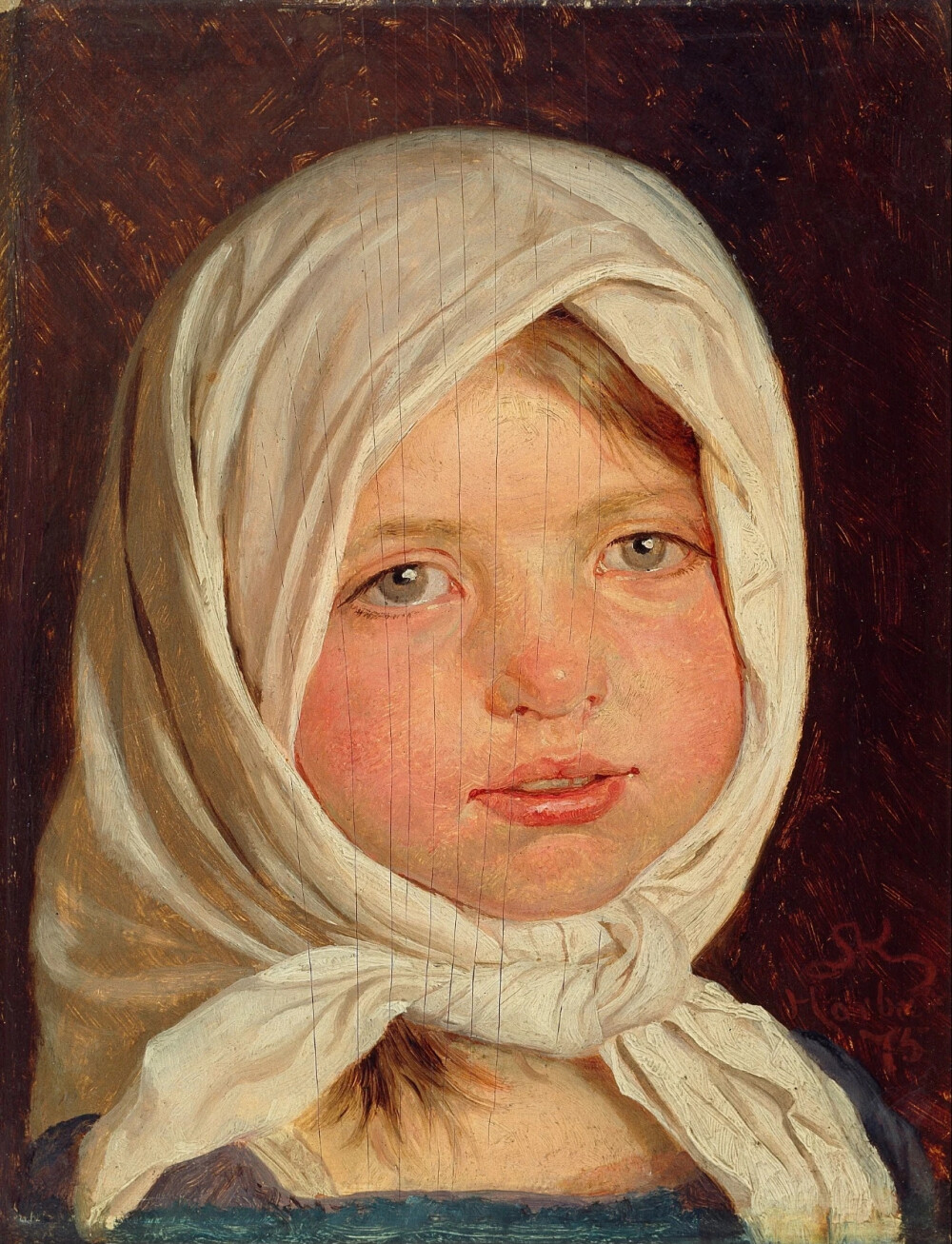 佩德·塞弗林·克罗耶（Peder Severin Krøyer，1851年-1909年）是丹麦艺术家中杰出的一位。克罗耶的视力使他在生命的最后十年逐渐失败，直到他完全失明。尽管有健康障碍，他还是个乐观主义者，几乎画到最后。实际上，他在半盲时画了他的一些最后的杰作，开玩笑说他的一只工作眼睛的视力随着另一只眼睛的消失而变得更好。
