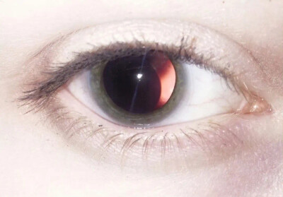 eye