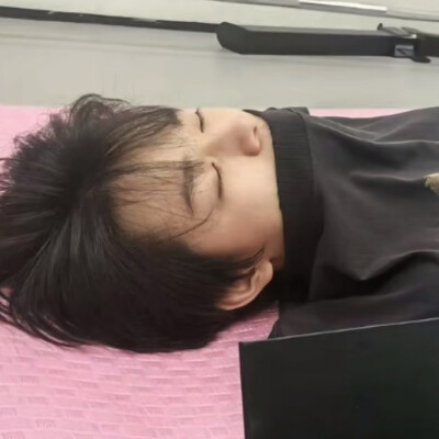 张极