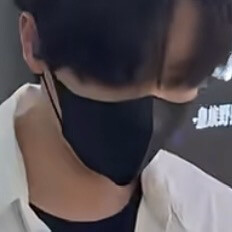 眼下痣