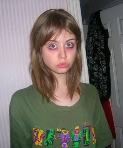 Allison Harvard