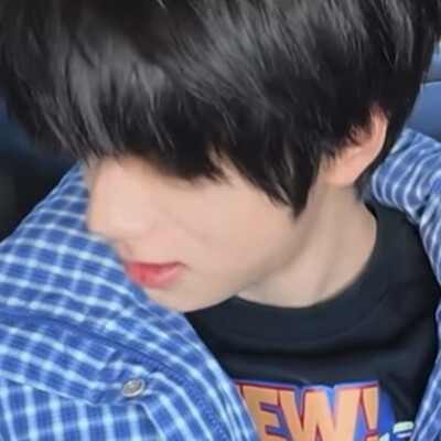 结膜炎可怜宝宝