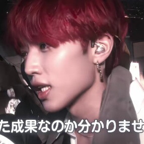 小鹿在乱撞 你头发