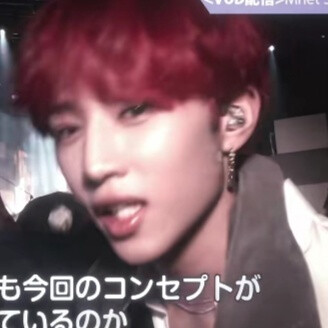 小鹿在乱撞 你头发