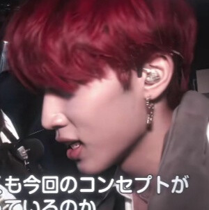 小鹿在乱撞 你头发