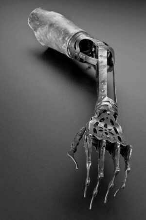 Victorian "rather sinister" artificial arm and hand,Europe,1850-1910