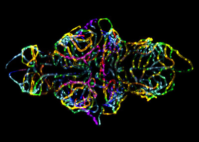 Zebrafish Embryo 活的斑马鱼胚胎中的血脑屏障