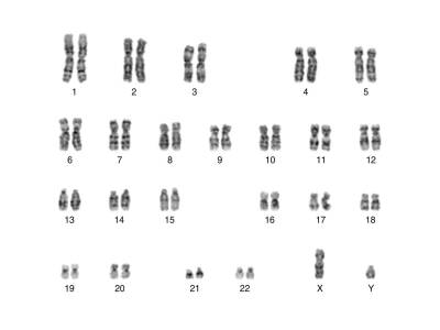 人类的46条染色体