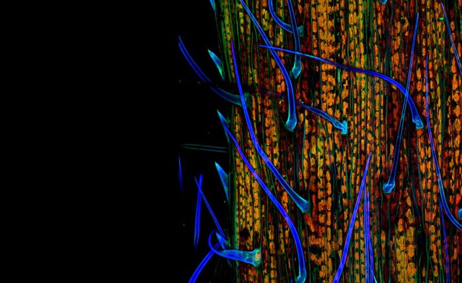 一根青草发出的自体荧光(放大200倍),该照片排名第2位,由来自宾夕法尼