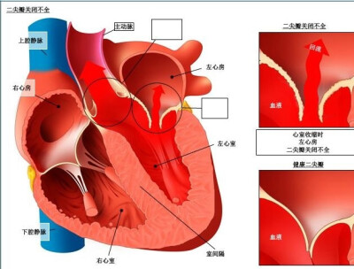 心脏解剖图