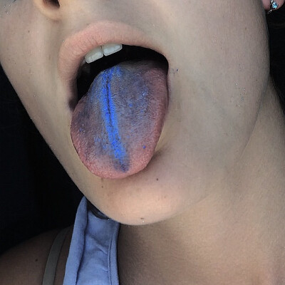 蓝舌