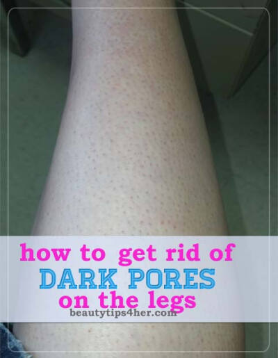 How to Get Rid of Dark Pores on the Legs | DIY Beauty Skincare and Health Tips