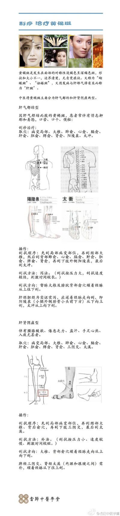 治疗黄褐斑