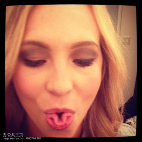 Candice Accola