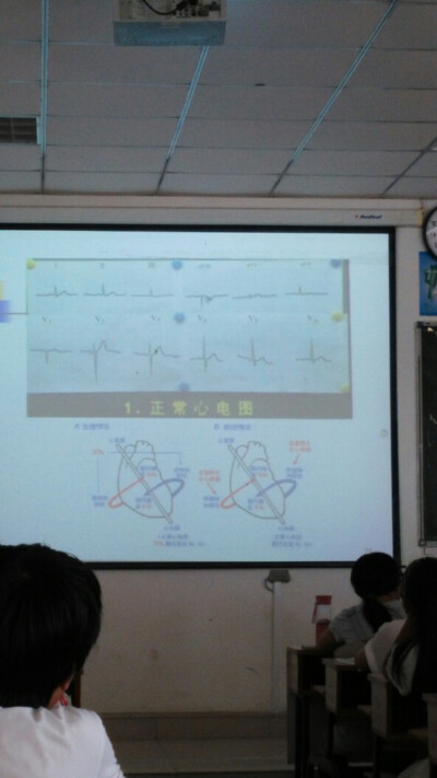 六、2、心电图（没听懂(｡•́︿•̀｡)）