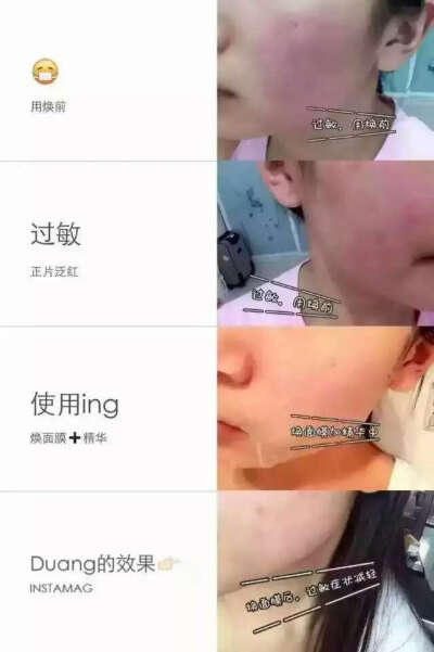 焕面膜美白，补水，保湿，淡斑，痘痘，收缩毛孔，修复防晒，过敏敏感肌肤都可以用