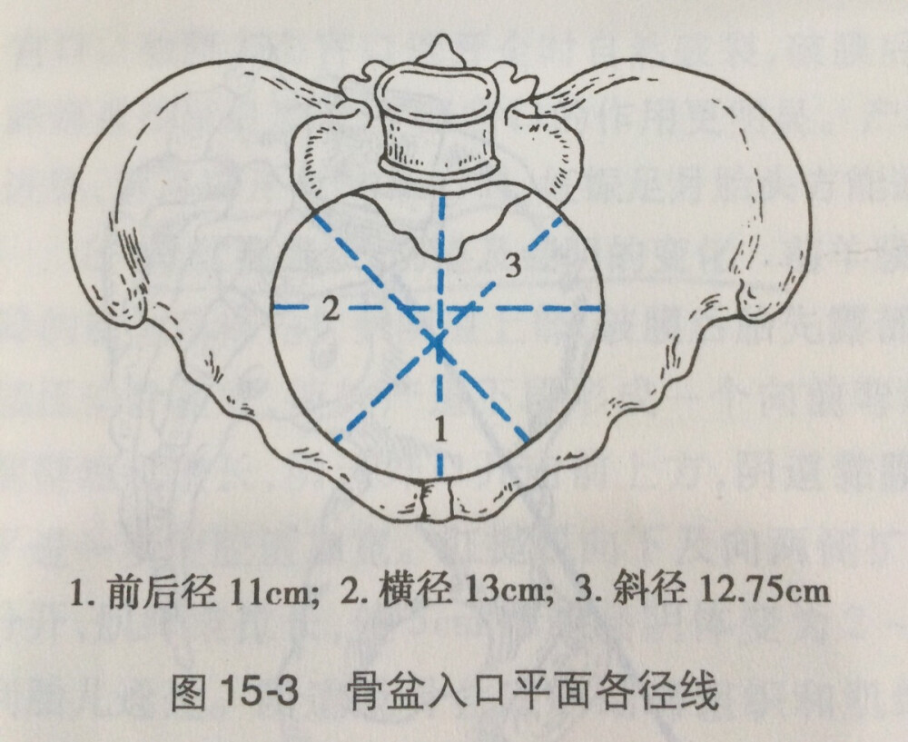 骨盆入口平面