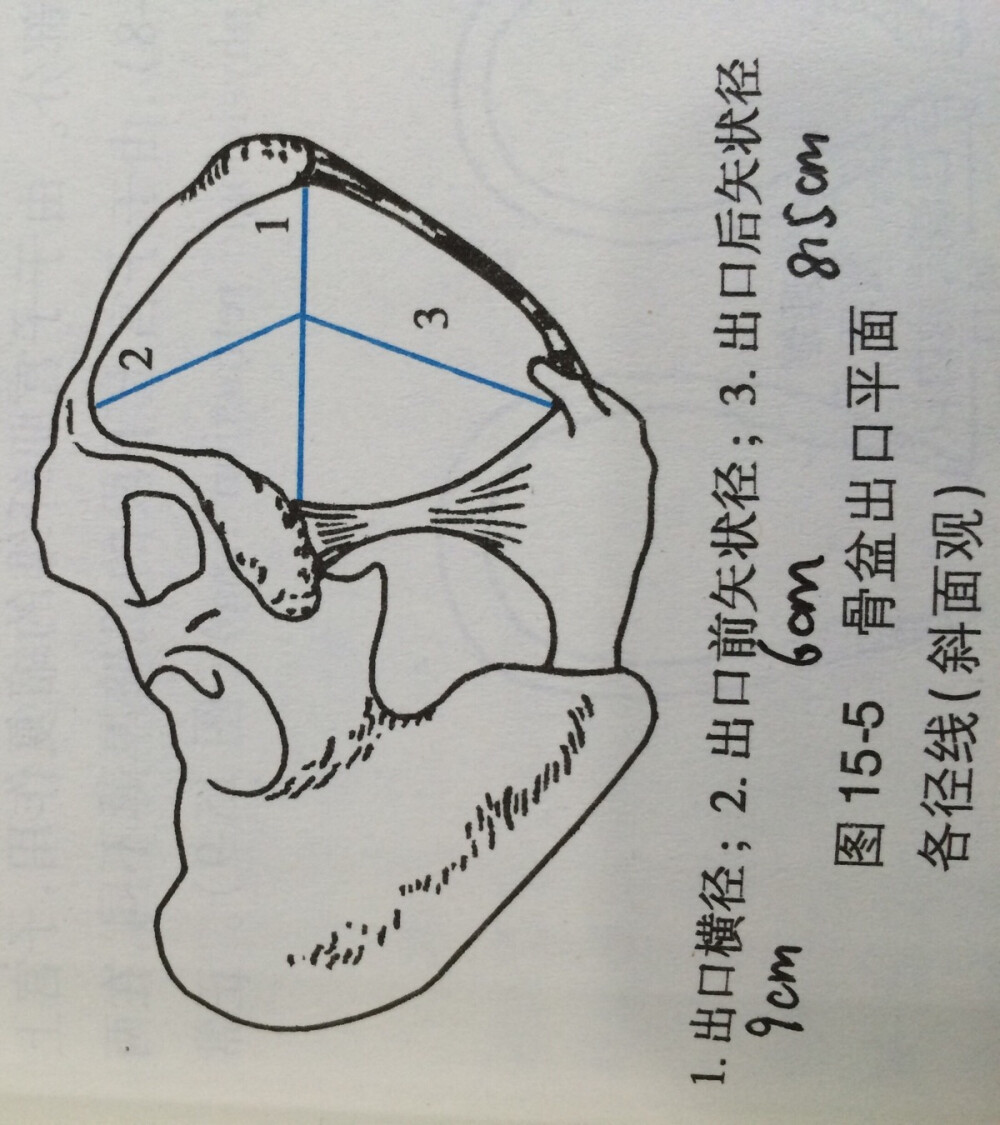 骨盆出口平面