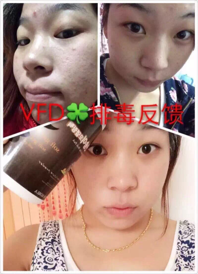 排毒膏，]其实每个女孩都应该备一瓶。功效：排汞铅，排毒素，细致毛孔，美白淡斑，紧致抗衰，促进新陈代谢，淡化黑色素，另皮肤通透白皙，配合上浓缩20倍的芦荟凝胶使用更棒，平时卸妆不干净，经常用BB、隔离、粉底…