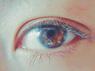 my eye。