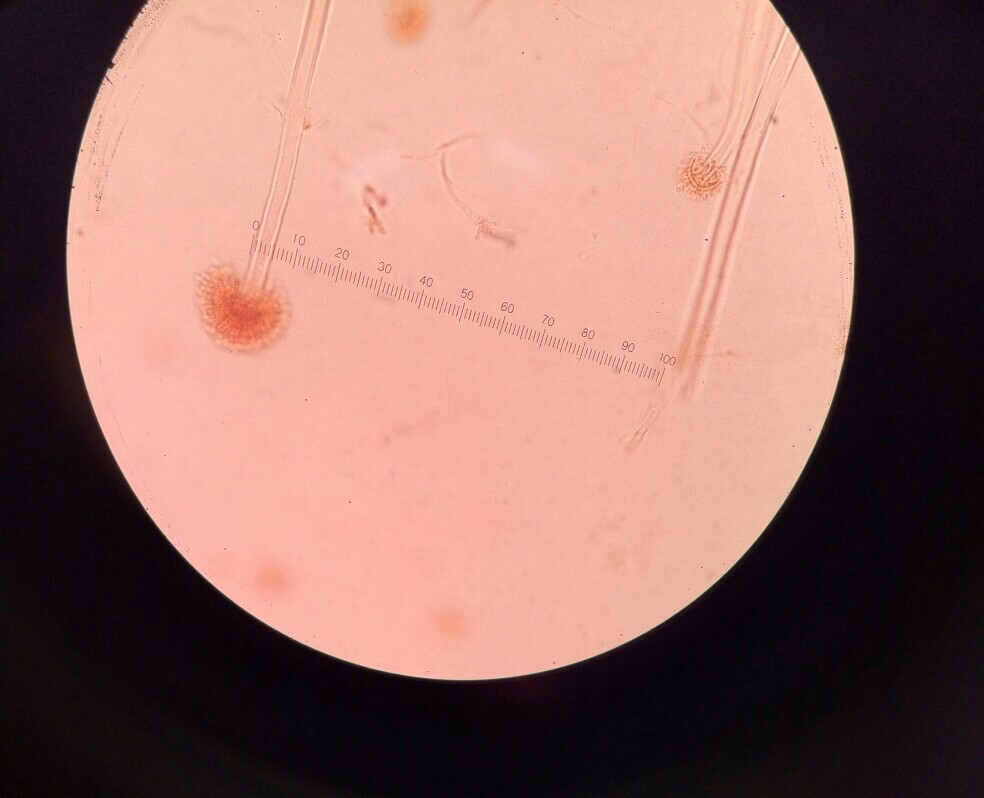 分生孢子梗图片图片