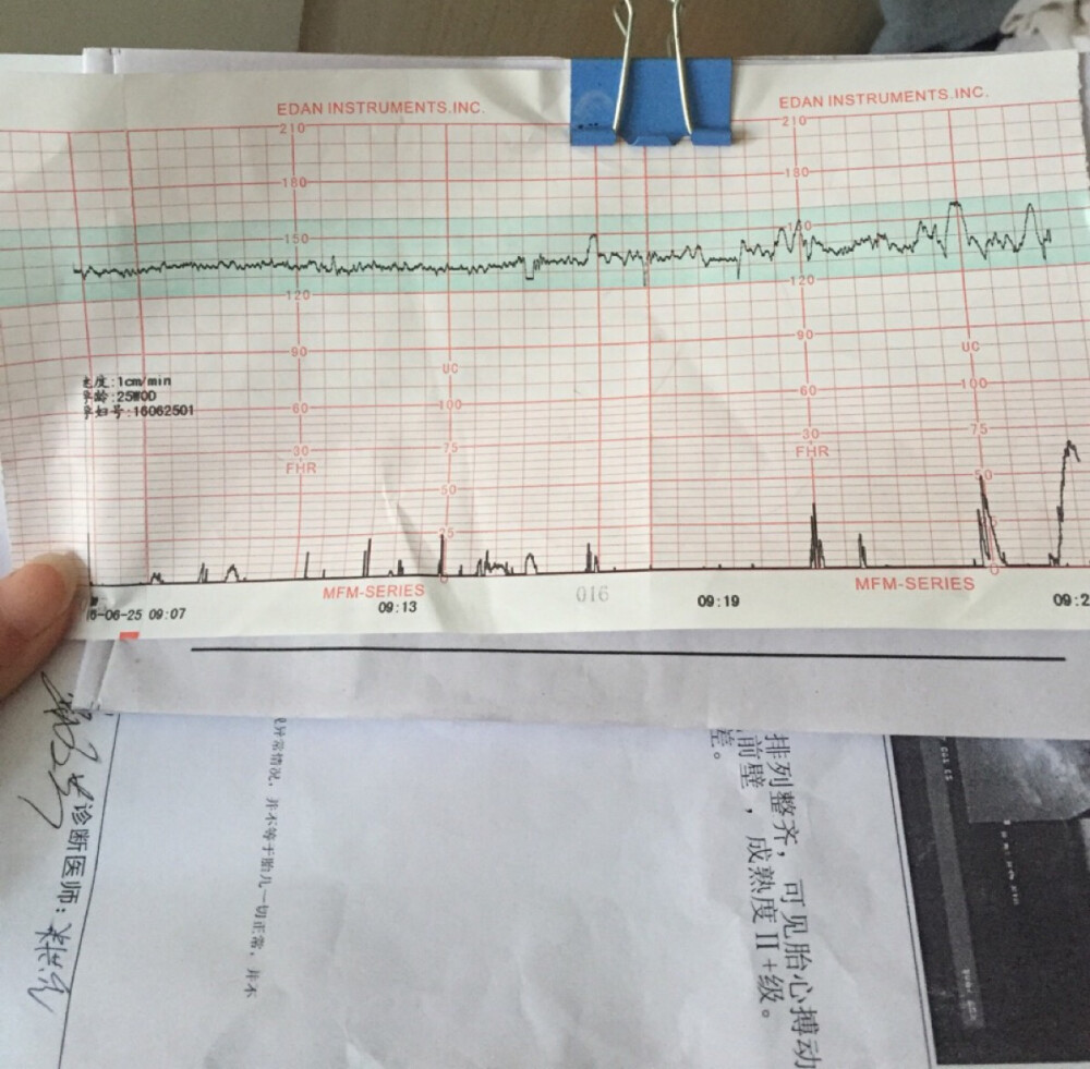 宝贝今天上午妈妈去医院做孕检 你刚开始睡着了妈妈以为你是缺氧呢 妈妈羊水不多有点混 你要坚强 快点和妈妈见面39+3