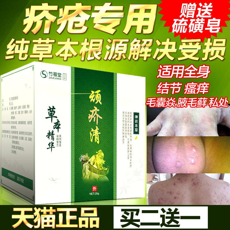 去除疥疮结节霜硫磺软膏疥虱康宁疥虫阴囊疥疮灵皮肤瘙痒疥疮膏