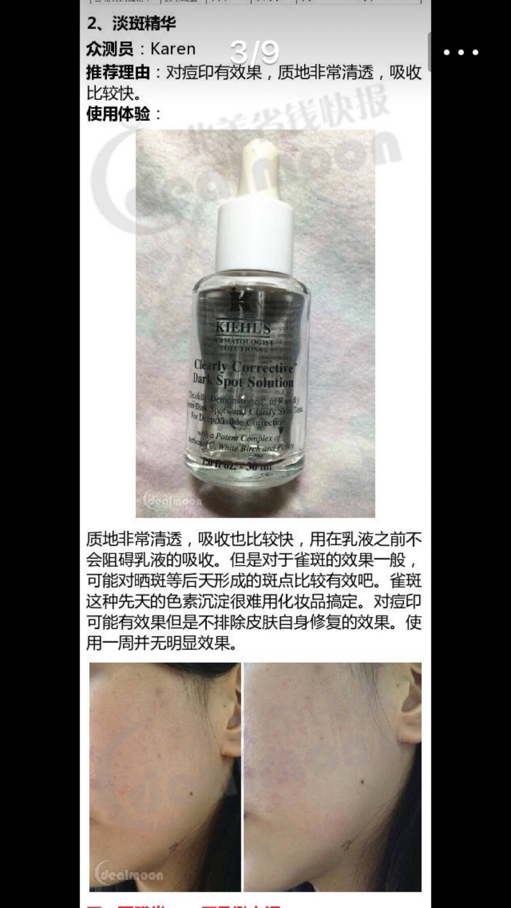 kiehls淡斑精华【对我没效果】