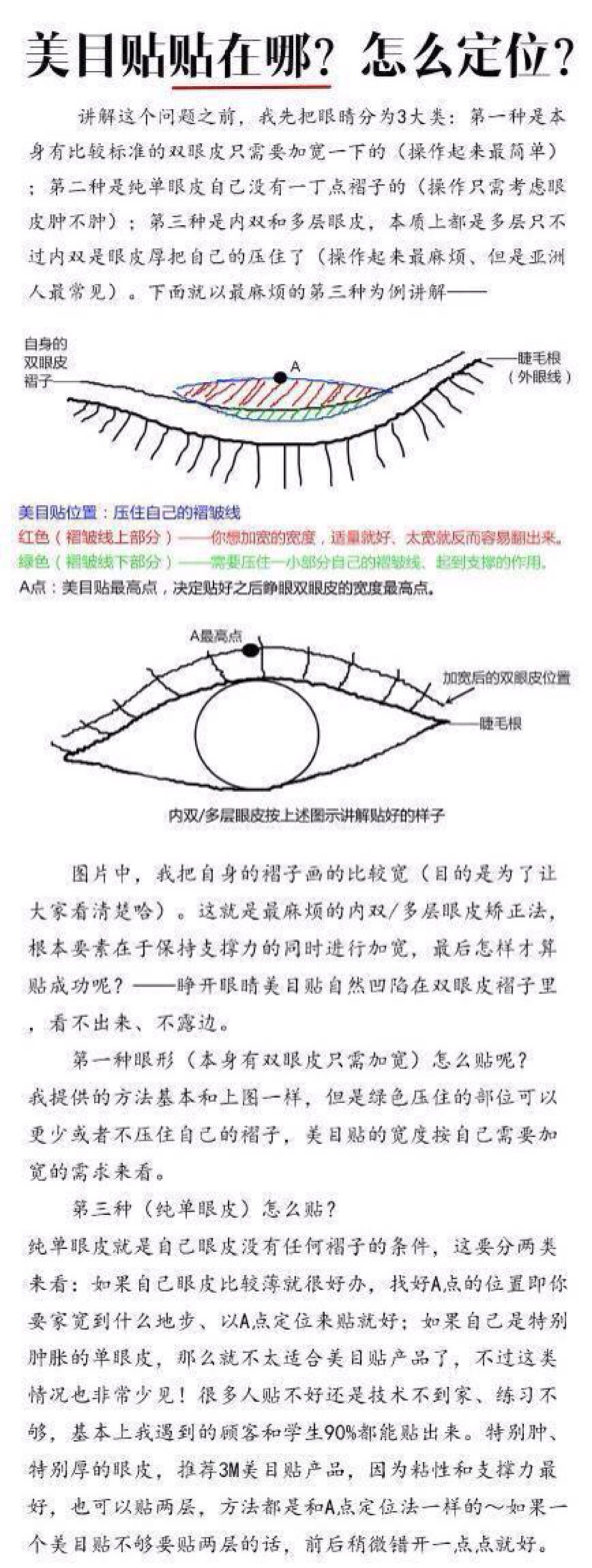 双眼皮贴心得