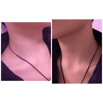 剪头发还是剪脖子