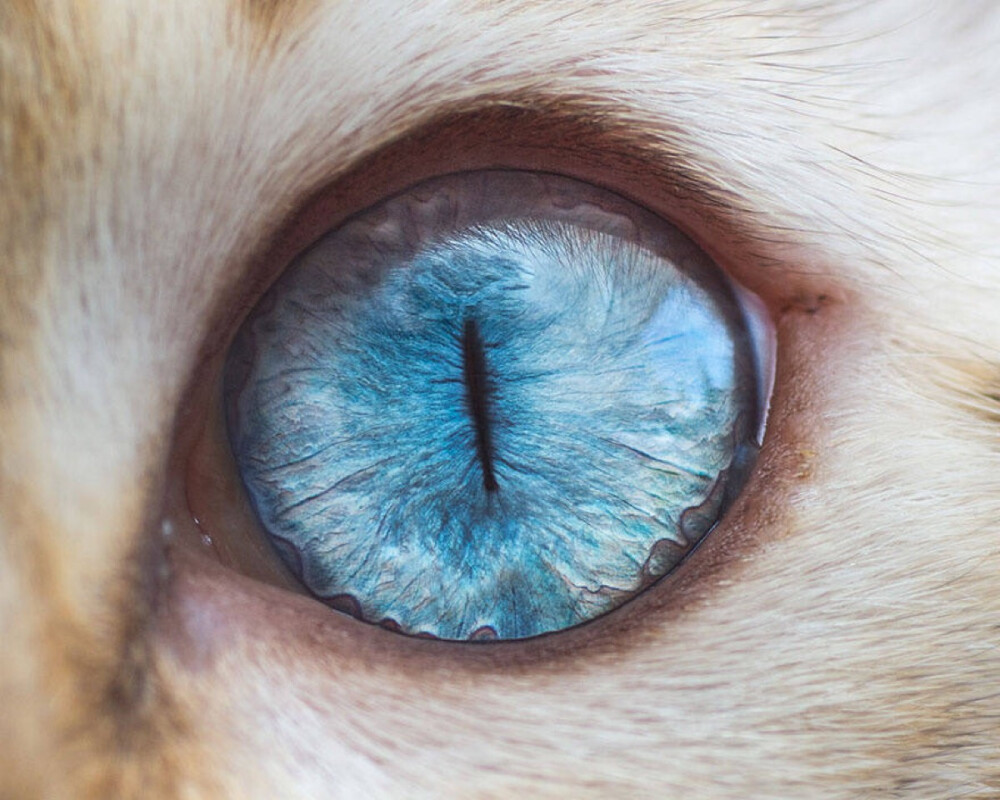 EYE